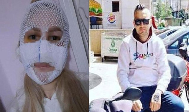 Sultan'ın yüzüne kimyasal atan sanığın cezasına Yargıtay'dan onama