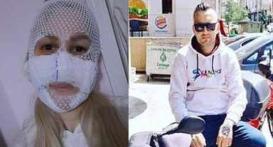Sultan'ın yüzüne kimyasal atan sanığın cezasına Yargıtay'dan onama