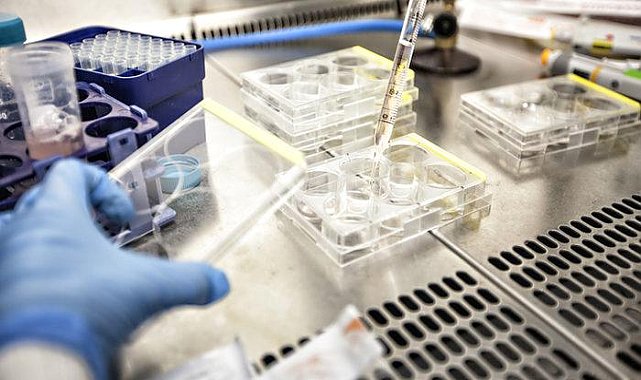 Tıp tarihine geçecek araştırmanın başında bir Türk var! Hastalıkların nedeni bulundu