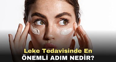 Leke tedavisinde en önemli adım nedir?