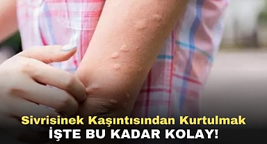 Sivrisinek Kaşıntısından Kurtulmak İşte Bu Kadar Kolay