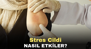 Stres Cildi Nasıl Etkiler?