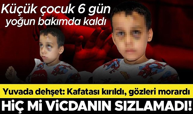 Yuvada bakıcı dehşeti! Dövüp yere fırlattığı çocuğun kafatası kırıldı, gözleri morardı
