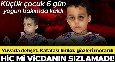 Yuvada bakıcı dehşeti! Dövüp yere fırlattığı çocuğun kafatası kırıldı, gözleri morardı