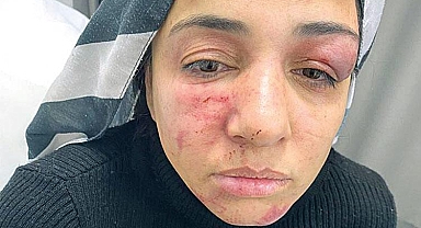 Sokak ortasında dövülen Songül’ün yardım çığlığı